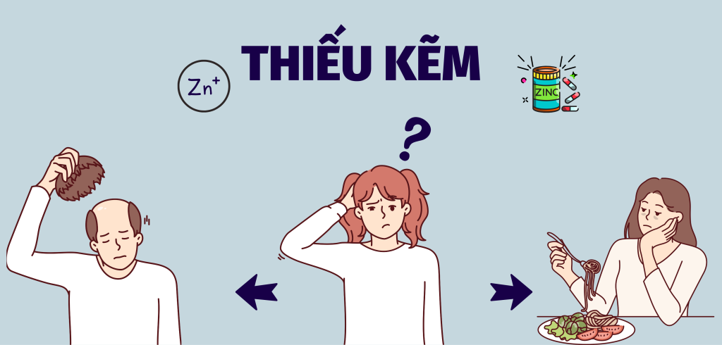 Thiếu Kẽm